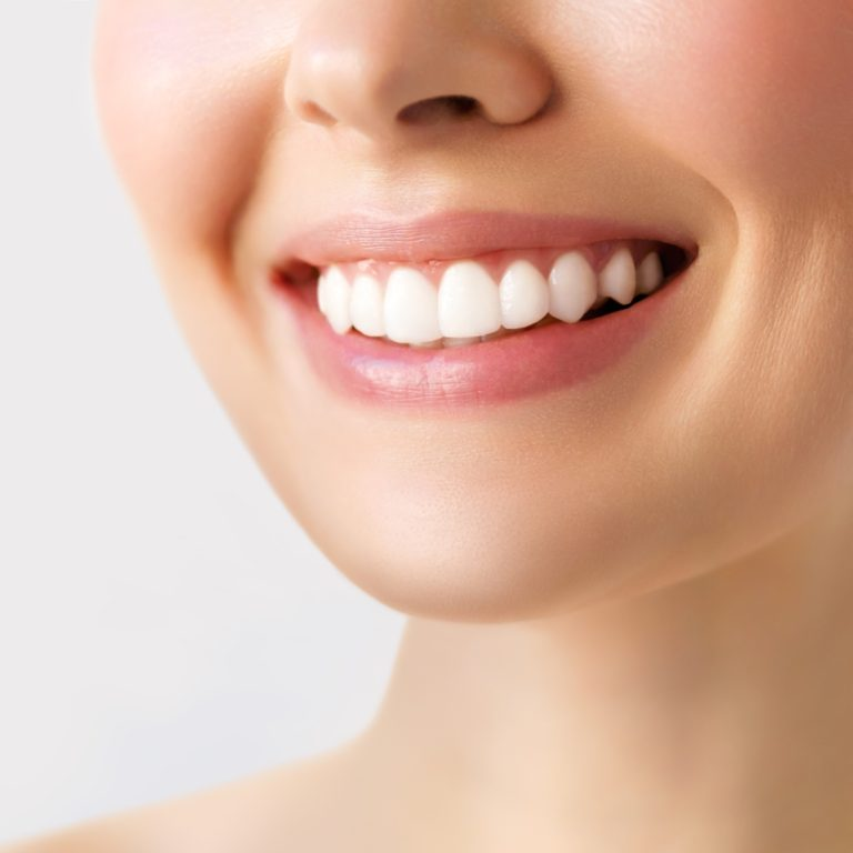 Woman with a bright, white smile after cosmetic dentistry treatment at Best Smile 4U Dentistry